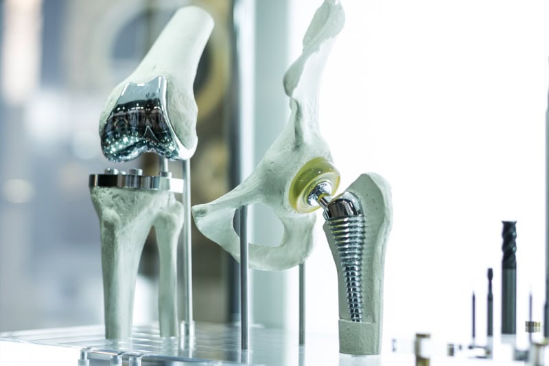 Assembly Services for Medical Implants